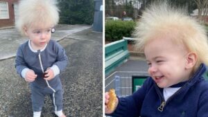 C’è un bambino che soffre di un particolare sindrome che gli impedisce di pettinare i capelli