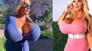 Era un’insegnante, oggi è una modella con una taglia 34, ma ecco alcune foto in cui si mostra prima della chirurgia plastica e…