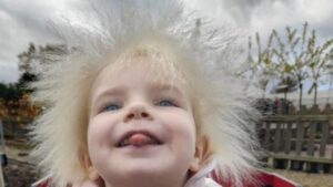 “Provo a insegnarle ad accettarsi”, le parole dela mamma della bambina con la Sindrome dei capelli spettinati